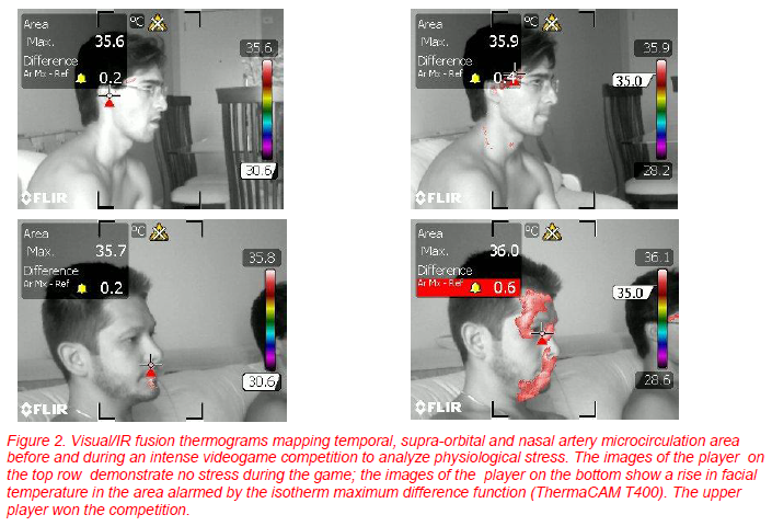imagecamlz.png